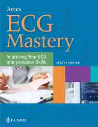 ECG Mastery: Improving Your ECG Interpretation Skills, 2nd