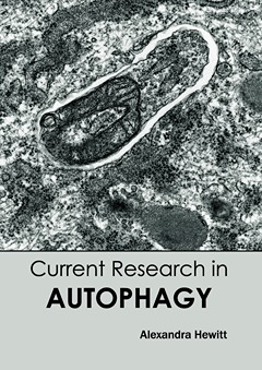 Current Research in Autophagy