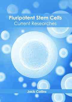 Pluripotent Stem Cells: Current Researches
