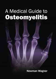 Medical Guide to Osteomyelitis