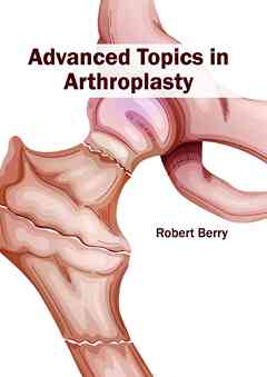 Advanced Topics in Arthroplasty