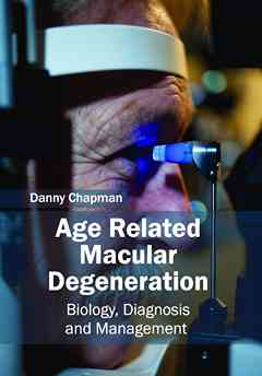 Age Related Macular Degeneration: Biology, Diagnosis and Management