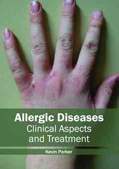 Allergic Diseases: Clinical Aspects and Treatment