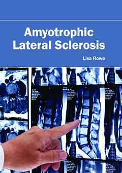 Amyotrophic Lateral Sclerosis