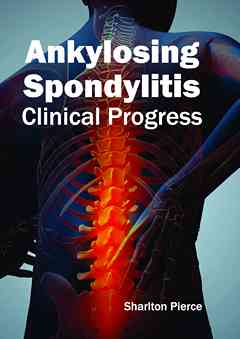 Ankylosing Spondylitis: Clinical Progress