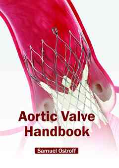 Aortic Valve Handbook