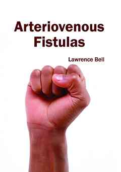 Arteriovenous Fistulas