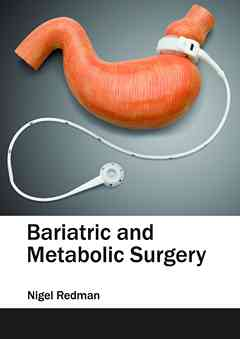 Bariatric and Metabolic Surgery