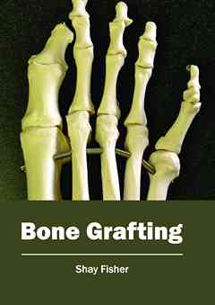 Bone Grafting