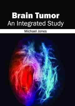 Brain Tumor: an Integrated Study