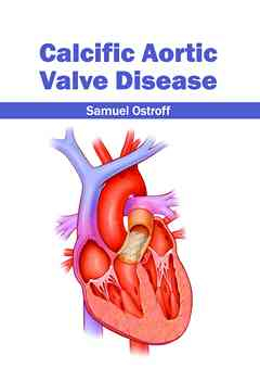 Calcific Aortic Valve Disease