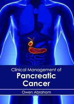 Clinical Management of Pancreatic Cancer