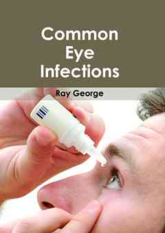 Common Eye Infections