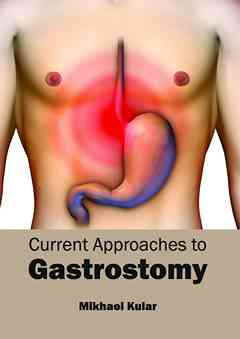 Current Approaches to Gastrostomy
