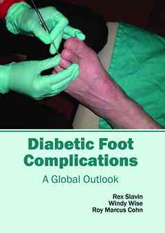 Diabetic Foot Complications: a Global Outlook