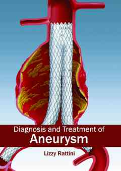 Diagnosis and Treatment of Aneurysm
