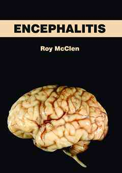 Encephalitis