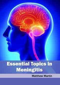 Essential Topics in Meningitis