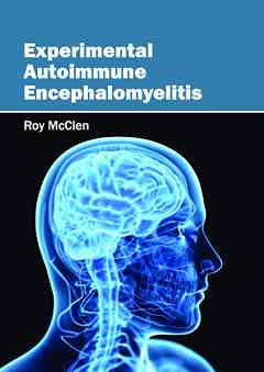 Experimental Autoimmune Encephalomyelitis