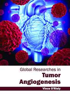 Global Researches in Tumor Angiogenesis