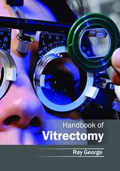 Handbook of Vitrectomy