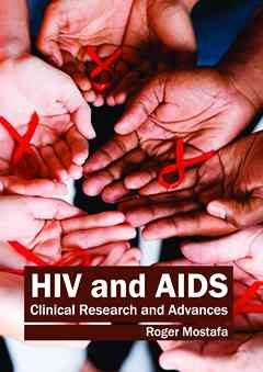 HIV and AIDS: Clinical Research and Advances