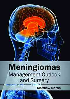 Meningiomas: Management Outlook and Surgery