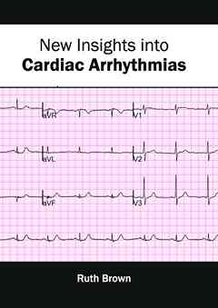 New Insights Into Cardiac Arrhythmias