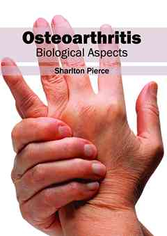 Osteoarthritis: Biological Aspects