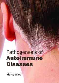 Pathogenesis of Autoimmune Diseases