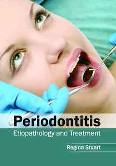 Periodontitis: Etiopathology and Treatment