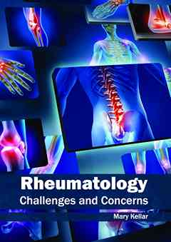 Rheumatology: Challenges and Concerns