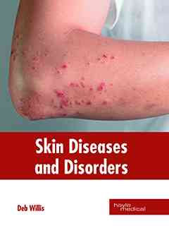 Skin Diseases and Disorders