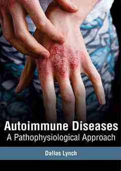 Autoimmune Diseases: A Pathophysiological Approach