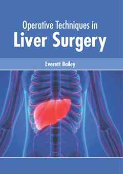 Operative Techniques in Liver Surgery