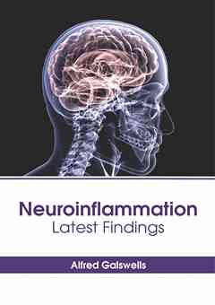 Neuroinflammation: Latest Findings