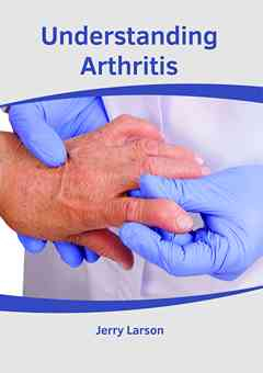 Understanding Arthritis