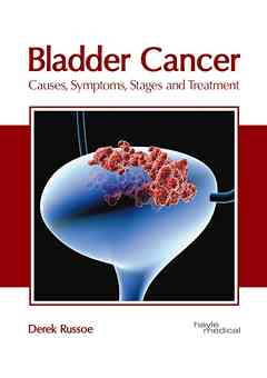 Bladder Cancer: Causes, Symptoms, Stages and Treatment