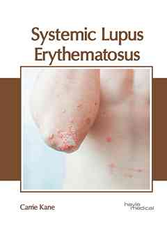 Systemic Lupus Erythematosus