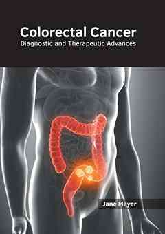 Colorectal Cancer: Diagnostic and Therapeutic Advances