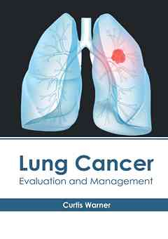 Lung Cancer: Evaluation and Management