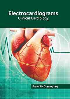 Electrocardiograms: Clinical Cardiology