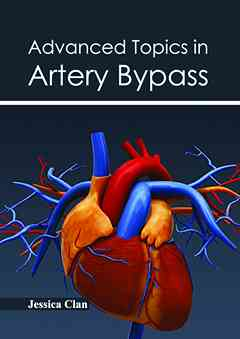 Advanced Topics in Artery Bypass