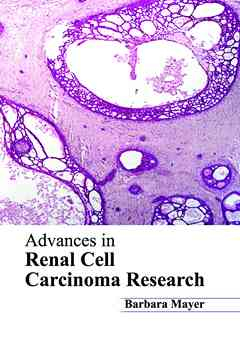 Advances in Renal Cell Carcinoma Research