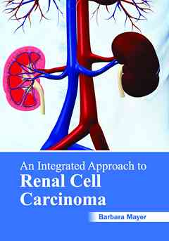 Integrated Approach to Renal Cell Carcinoma