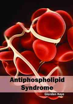 Antiphospholipid Syndrome