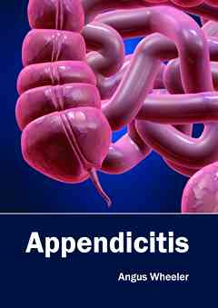 Appendicitis
