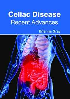 Celiac Disease: Recent Advances