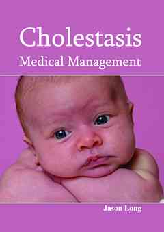 Cholestasis: Medical Management