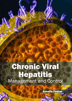 Chronic Viral Hepatitis: Management and Control